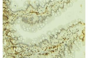 ABIN6277100 at 1/100 staining Mouse colon tissue by IHC-P. (SMARCA4 anticorps  (N-Term))