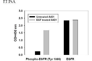 Image no. 4 for Epidermal Growth Factor Receptor (EGFR) ELISA Kit (ABIN625237) (EGFR Kit ELISA)
