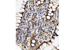 IHC analysis of MED4 using anti-MED4 antibody (ABIN7600817). (MED4 anticorps  (AA 24-254))
