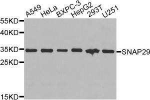Western blot analysis of extracts of various cell lines, using SNAP29 antibody. (SNAP29 anticorps)