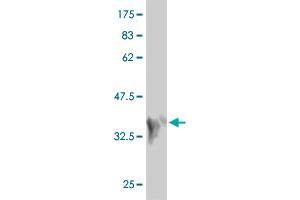 Western Blot detection against Immunogen (36. (MAP2K7 anticorps  (AA 1-99))