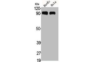 Western Blot analysis of HuvEc HELA cells using ADAMTS-1 Polyclonal Antibody (ADAMTS1 anticorps  (Internal Region))