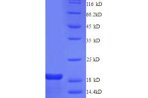 SDS-PAGE (SDS) image for Gap Junction Protein, alpha 1, 43kDa (GJA1) (AA 233-382), (Cytoplasmic Domain), (Cytosolic) protein (His tag) (ABIN5713124)