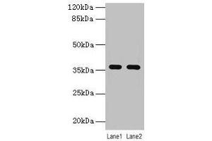 Western blot All lanes: LYPD3 antibody at 4 μg/mL Lane 1: MCF-7 whole cell lysate Lane 2: Mouse stomach tissue Secondary Goat polyclonal to rabbit IgG at 1/10000 dilution Predicted band size: 36 kDa Observed band size: 36 kDa (LYPD3 anticorps  (AA 31-326))