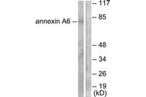 Western blot analysis of extracts from 293 cells, using Annexin A6 Antibody. (ANXA6 anticorps  (AA 1-50))