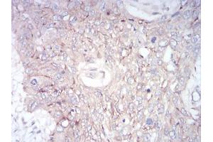Immunohistochemistry (IHC) image for anti-Zinc Finger Protein GLI1 (GLI1) (AA 284-449) antibody (ABIN5866847) (GLI1 anticorps  (AA 284-449))