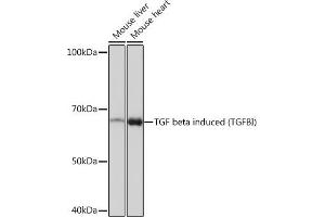 Western blot analysis of extracts of various cell lines, using TGF beta induced TGF beta induced (TGFBI) Rabbit mAb (ABIN7270915) at 1:1000 dilution. (TGFBI anticorps)