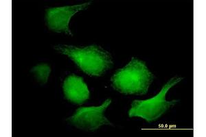 Immunofluorescence of monoclonal antibody to AK1 on HeLa cell. (Adenylate Kinase 1 anticorps  (AA 1-194))