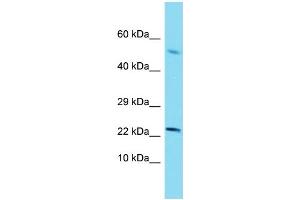 Western Blotting (WB) image for anti-Sterol Carrier Protein 2 (SCP2) (N-Term) antibody (ABIN2774151) (SCP2 anticorps  (N-Term))