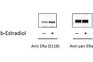 ZR751 cells were untreated or treated with b-estradiol for 1 hour. (Estrogen Receptor alpha Kit ELISA)