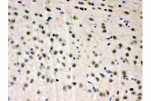 Anti- VCP Picoband antibody, IHC(P) IHC(P): Rat Brain Tissue