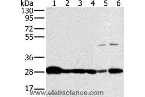 Western blot analysis of Mouse brain and human fetal brain tissue, hela, Raw264. (NDUFS3 anticorps)