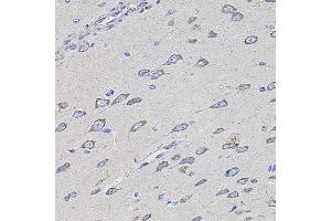 Immunohistochemistry of paraffin-embedded rat brain using TMC1 antibody (ABIN6134923, ABIN6149240, ABIN6149242 and ABIN6224704) at dilution of 1:100 (40x lens). (TMC1 anticorps  (AA 600-700))