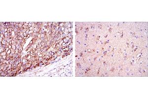 Immunohistochemical analysis of paraffin-embedded liver cancer tissues (left) and brain tissues (right) using ApoE mouse mAb with DAB staining.