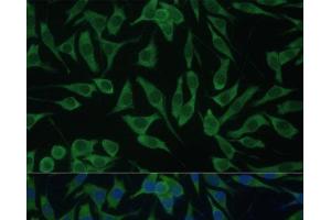 Immunofluorescence analysis of L929 cells using DDX3Y Polyclonal Antibody at dilution of 1:100 (40x lens). (DDX3Y anticorps)