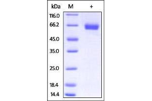Mouse IL-4 R alpha, Fc Tag on SDS-PAGE under reducing (R) condition. (IL4 Receptor Protein (AA 26-233) (Fc Tag))
