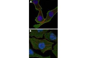 Confocal immunofluorescence analysis of SK-BR-3 (A) and A-549 (B) cells using CALR monoclonal antibody, clone 1G6A7  (green). (Calreticulin anticorps)