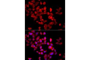 Immunofluorescence analysis of A549 cells using EIF4G1 antibody. (EIF4G1 anticorps)