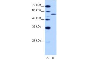 Western Blotting (WB) image for anti-Zinc Finger (CCCH Type), RNA-Binding Motif and serine/arginine Rich 2 (ZRSR2) antibody (ABIN2462182) (ZRSR2 anticorps)