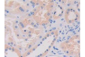 Used in DAB staining on fromalin fixed paraffin- embedded kidney tissue (LRRFIP1 anticorps  (AA 615-735))