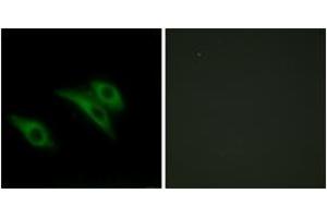 Immunofluorescence analysis of HeLa cells, using CD9 Antibody. (CD9 anticorps  (AA 101-150))