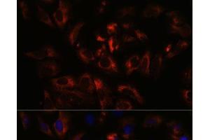 Immunofluorescence analysis of U-2 OS cells using RAB27A Polyclonal Antibody at dilution of 1:100. (RAB27A anticorps)