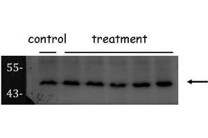 WB Image Sample (30 ug of whole cell lysate) A: Hela 10% SDS PAGE ORC4L antibody antibody diluted at 1:1000
