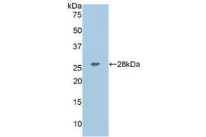 Detection of Recombinant COL1a1, Human using Polyclonal Antibody to Collagen Type I Alpha 1 (COL1a1) (COL1A1 anticorps  (AA 1218-1440))