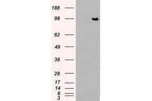 Image no. 5 for anti-TYRO3 Protein Tyrosine Kinase (TYRO3) antibody (ABIN1501608)