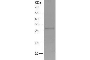 Western Blotting (WB) image for CTD (Carboxy-terminal Domain, RNA Polymerase II, Polypeptide A) Small Phosphatase 1 (CTDSP1) (AA 1-260) protein (His tag) (ABIN7122508)