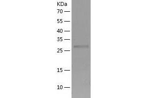 Western Blotting (WB) image for CTD (Carboxy-terminal Domain, RNA Polymerase II, Polypeptide A) Small Phosphatase 1 (CTDSP1) (AA 1-260) protein (His tag) (ABIN7122508) (CTDSP1 Protein (AA 1-260) (His tag))