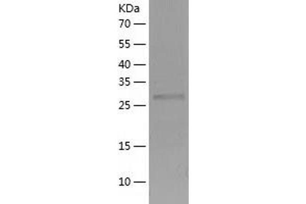 CTDSP1 Protein (AA 1-260) (His tag)