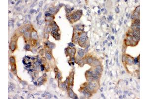Immunohistochemistry (Paraffin-embedded Sections) (IHC (p)) image for anti-Sulfotransferase Family, Cytosolic, 2B, Member 1 (SULT2B1) (AA 190-218), (Middle Region) antibody (ABIN3043414) (SULT2B1 anticorps  (Middle Region))