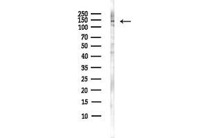 Western blot analysis of lysates from Hela cells(heat-shock,45 min treatment), using RFX1 Antibody at 1/1000 dilution.