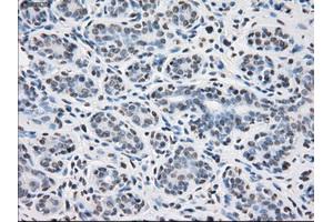 Immunohistochemical staining of paraffin-embedded breast tissue using anti-PPP5C mouse monoclonal antibody. (PP5 anticorps)