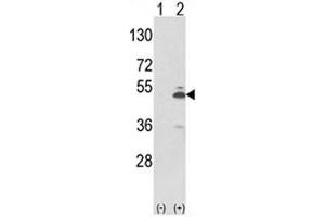 Western blot analysis of PKM2 antibody and 293 cell lysate (2 ug/lane) either nontransfected (Lane 1) or transiently transfected with the PKM2 gene (2).