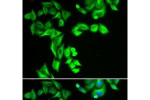 Immunofluorescence analysis of HeLa cells using STRN3 Polyclonal Antibody (STRN3 anticorps)