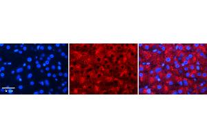 Rabbit Anti-ALDOB Antibody   Formalin Fixed Paraffin Embedded Tissue: Human Liver Tissue Observed Staining: Cytoplasm in hepatocytes Primary Antibody Concentration: N/A Other Working Concentrations: 1:600 Secondary Antibody: Donkey anti-Rabbit-Cy3 Secondary Antibody Concentration: 1:200 Magnification: 20X Exposure Time: 0.