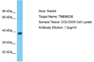 Host: Rabbit Target Name: TMEM236 Sample Tissue: Human COLO205 Whole Cell Antibody Dilution: 1ug/ml (TMEM236 anticorps  (Middle Region))