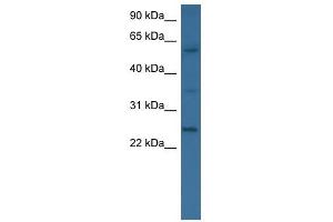 BMP6 antibody used at 0. (BMP6 anticorps  (N-Term))