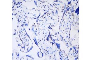 IHC analysis of HP1 gamma using anti-HP1 gamma antibody (ABIN5693033). (CBX3 anticorps  (AA 2-183))