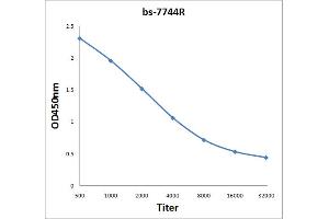 Antigen: 2 µg/100 µL  Primary: Antiserum, 1:500, 1:1000, 1:2000, 1:4000, 1:8000, 1:16000, 1:32000;  Secondary: HRP conjugated Rabbit Anti-Goat IgG at 1: 5000;  TMB staining Read the data in Microplate Reader by 450nm. (CHMP4B anticorps  (AA 101-200))
