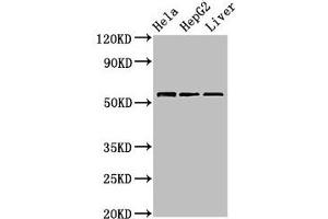 Western Blot Positive WB detected in: Hela whole cell lysate, HepG2 whole cell lysate, Mouse liver tissue All lanes: TOM1 antibody at 2. (TOM1 anticorps  (AA 306-487))