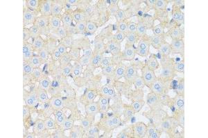 Immunohistochemistry of paraffin-embedded Rat liver using ASGR1 Polyclonal Antibody at dilution of 1:100 (40x lens). (Asialoglycoprotein Receptor 1 anticorps)