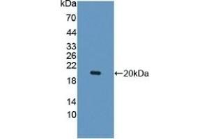 Detection of Recombinant IL10Rb, Human using Polyclonal Antibody to Interleukin 10 Receptor Beta (IL10Rb) (IL10RB anticorps  (AA 87-243))