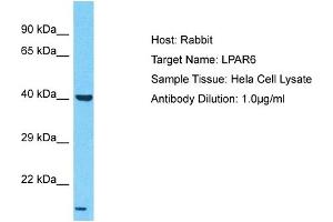 Host: Rabbit Target Name: LPAR6 Sample Type: Hela Whole Cell lysates Antibody Dilution: 1. (LPAR6 anticorps  (N-Term))