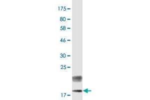 Western Blot detection against Immunogen (16.
