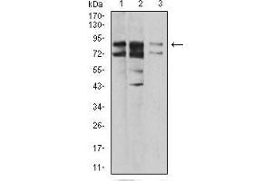 Western blot analysis using IL1RAPL1 mouse mAb against A431 (1), SK-Hep-1 (2), and HL-7702 (3) cell lysate. (IL1RAPL1 anticorps  (AA 541-694))