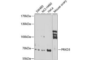Western blot analysis of extracts of various cell lines, using PRKD3 antibody (ABIN6128465, ABIN6146216, ABIN6146217 and ABIN6222885) at 1:1000 dilution. (PRKD3 anticorps  (AA 1-100))