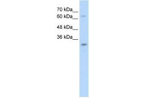 WB Suggested Anti-NSMCE1 Antibody Titration:  2. (NSMCE1 anticorps  (N-Term))